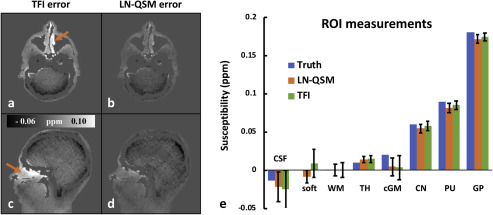 Image for Whole Head Quantitative Susceptibility Mapping Using a Least-norm Direct Dipole Inversion Method