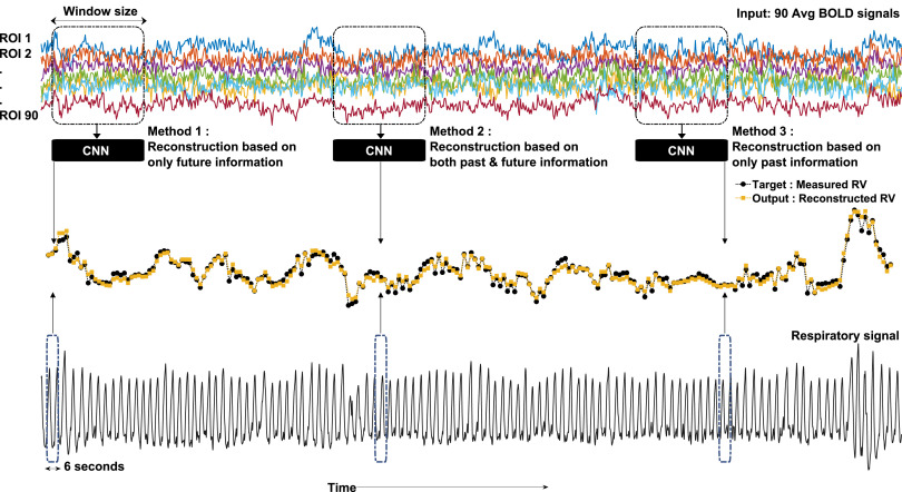 Image for Direct Machine Learning Reconstruction of Respiratory Variation Waveforms from Resting State fMRI Data in a Pediatric Population