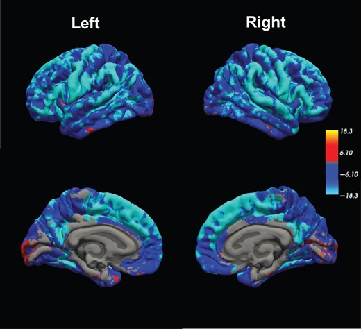 Image for Interdatabase Variability of Cortical Thickness Measurements