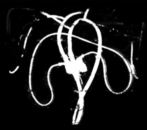 Image for Closed-Loop Circulation Phantom with Heart and Lung Motion for Validating Passive Magnetic Resonance Catheter Tracking