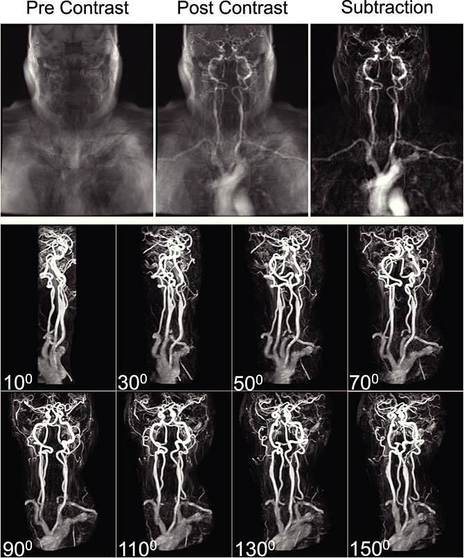 Image for Magnetic Resonance Imaging: A Review of State-of-the-Art Approaches, Methods and Techniques