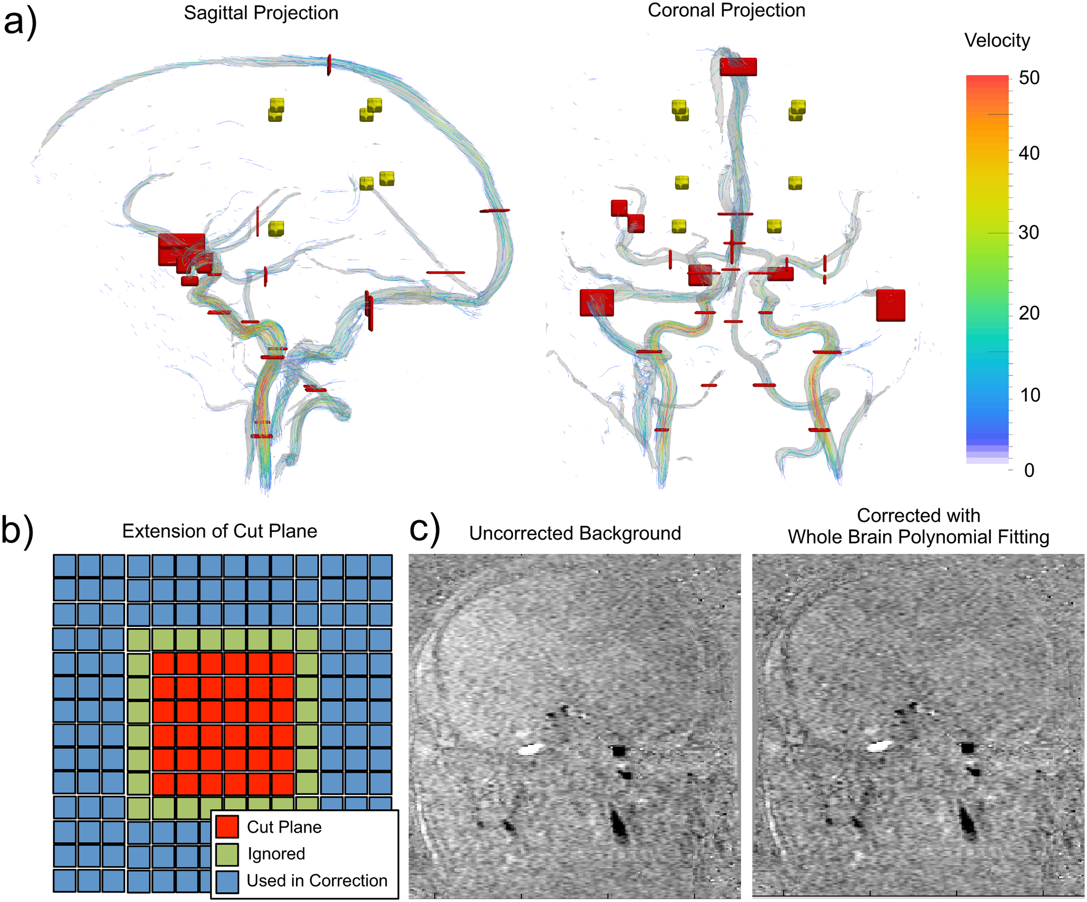 Image for Phase Error Correction in Time-Averaged 3D Phase Contrast Magnetic Resonance Imaging of the Cerebral Vasculature