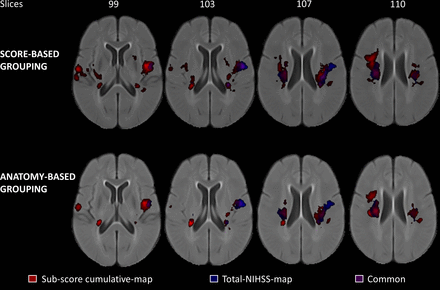 Image for Lesion-symptom mapping with NIHSS sub-scores in ischemic stroke patients