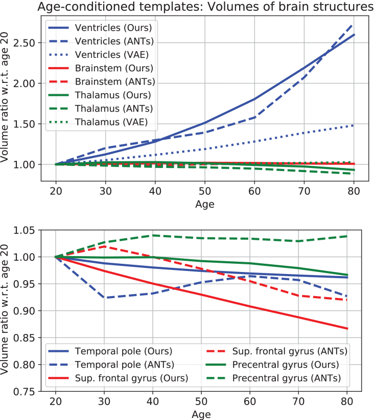 Image for A Bidirectional Normalizing Flow Model of Brain Aging