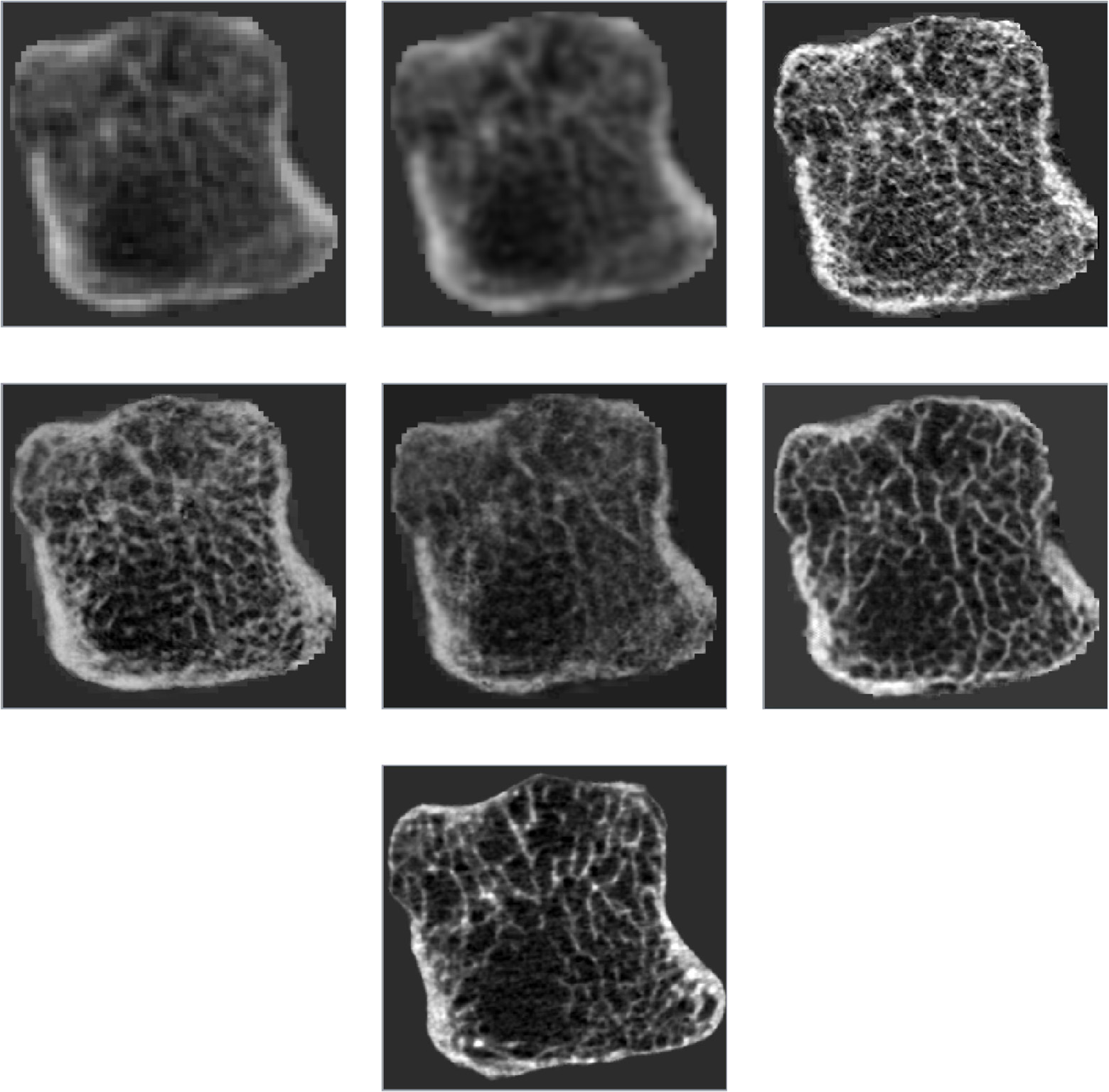 Image for CL-GAN: A Progressive Curriculum Learning Approach for Bone CT Super-Resolution